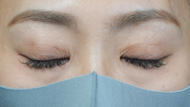 Postoperative Condition Part 1