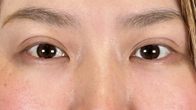 Postoperative Condition Part 1