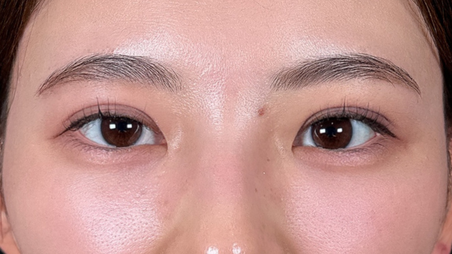 Postoperative Condition Part 1