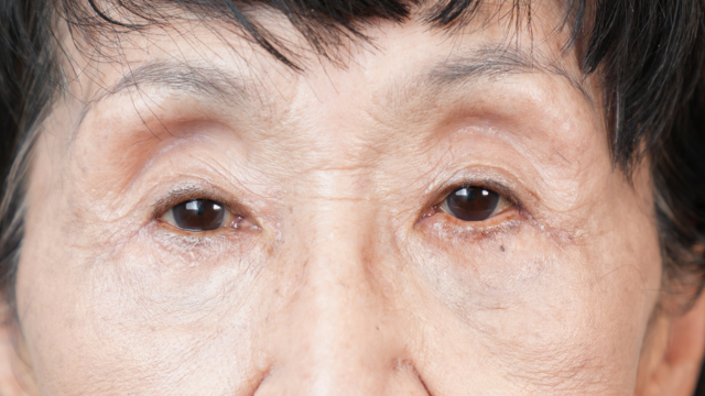 Postoperative Condition Part 1