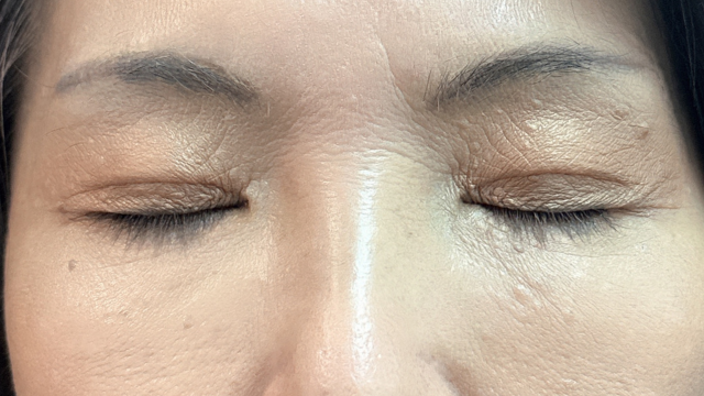 Postoperative Condition Part 1