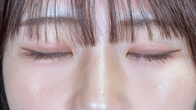 Postoperative Condition Part 1