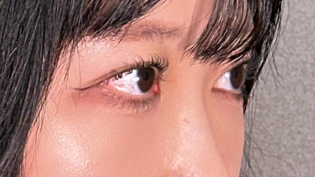 Postoperative Condition Part 1