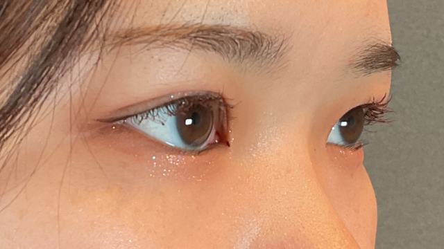 Postoperative Condition Part 1