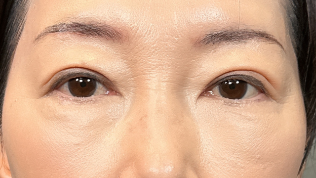 Postoperative Condition Part 1