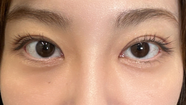 Postoperative Condition Part 1