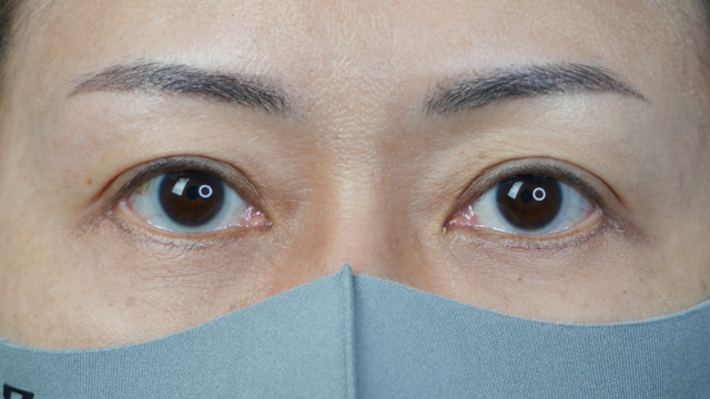 Postoperative Condition Part 1