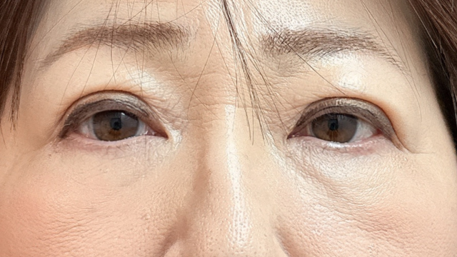 Postoperative Condition Part 1