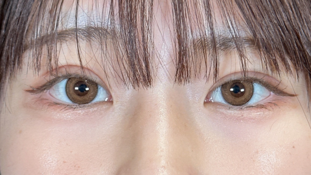 Postoperative Condition Part 1