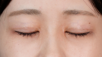 Postoperative Condition Part 1