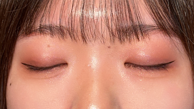 Postoperative Condition Part 1