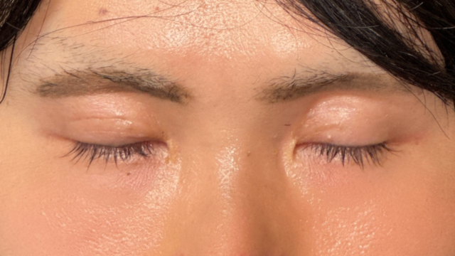 Postoperative Condition Part 1