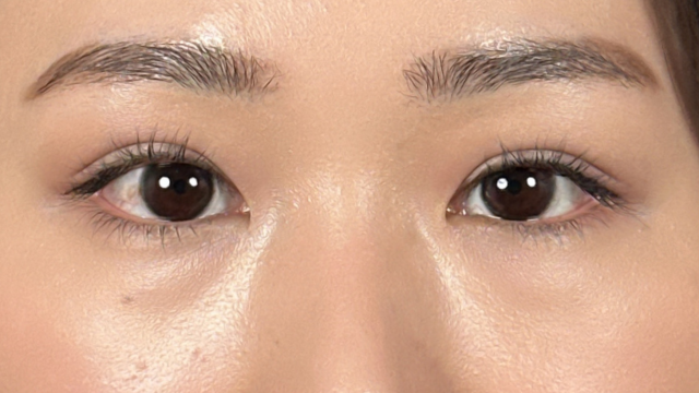 Postoperative Condition Part 1