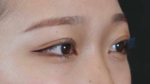 Postoperative Condition Part 1