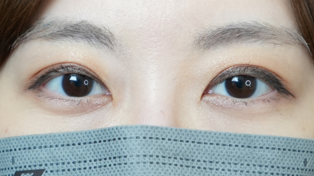 Postoperative Condition Part 1