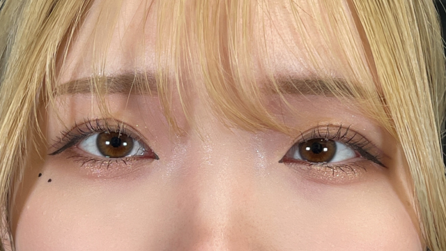 Postoperative Condition Part 1