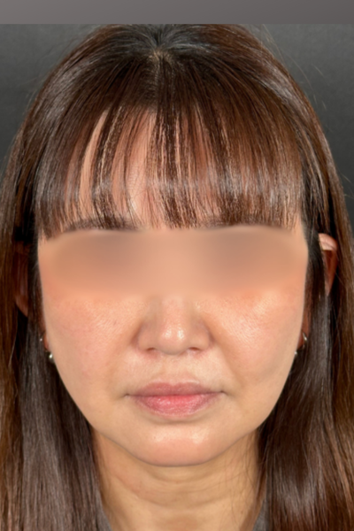 Postoperative Condition Part 1