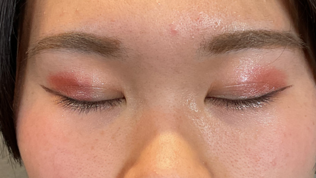 Postoperative Condition Part 1