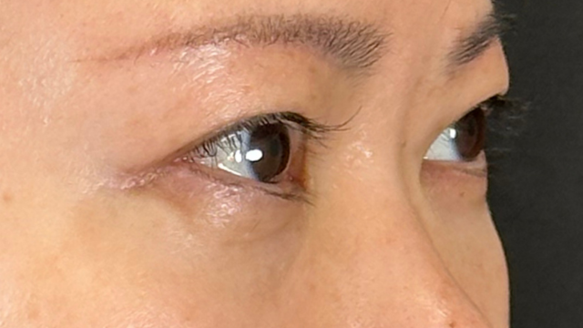 Postoperative Condition Part 1