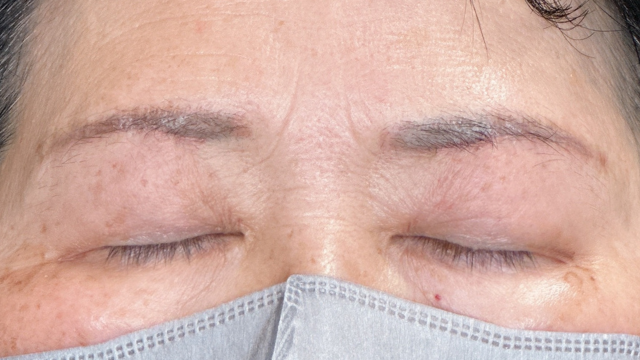 Postoperative Condition Part 1