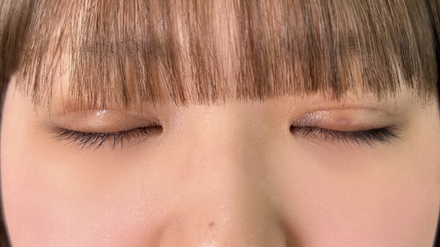 Postoperative Condition Part 1