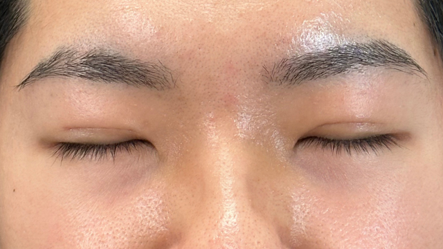 Postoperative Condition Part 1