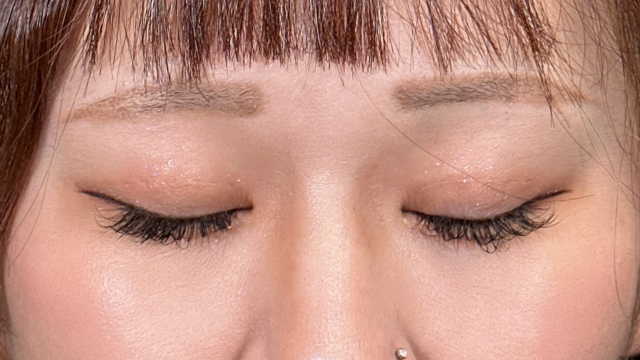 Postoperative Condition Part 1