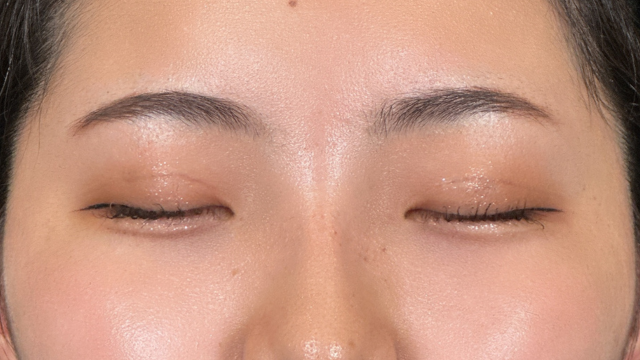 Postoperative Condition Part 1