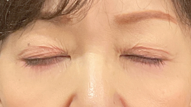 Postoperative Condition Part 1