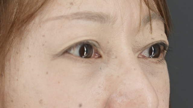 Postoperative Condition Part 1