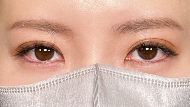 Postoperative Condition Part 1