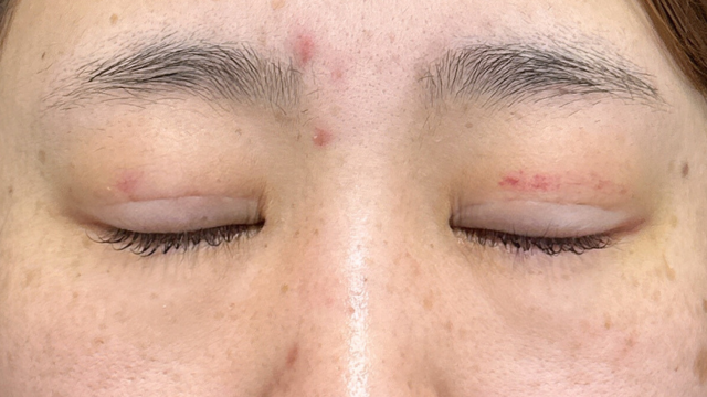 Postoperative Condition Part 1