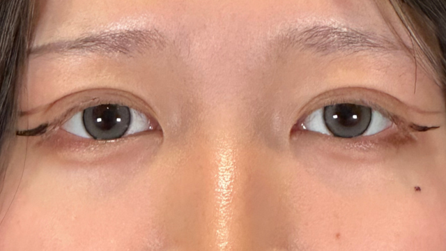 Postoperative Condition Part 1