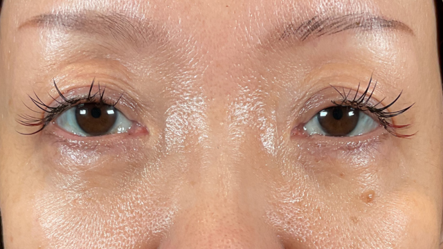 Postoperative Condition Part 1