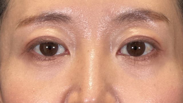 Postoperative Condition Part 1