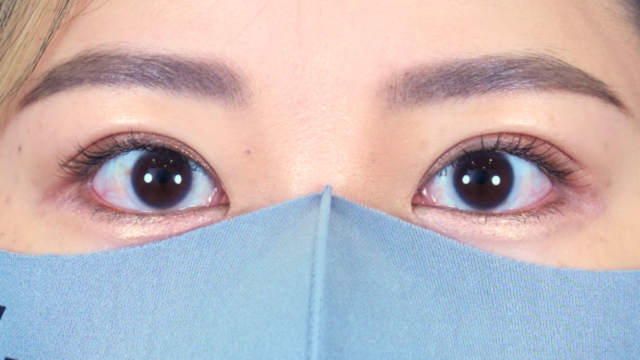 Postoperative Condition Part 1