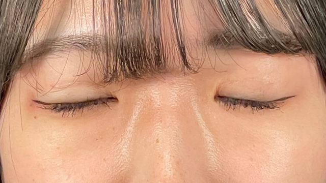 Postoperative Condition Part 1