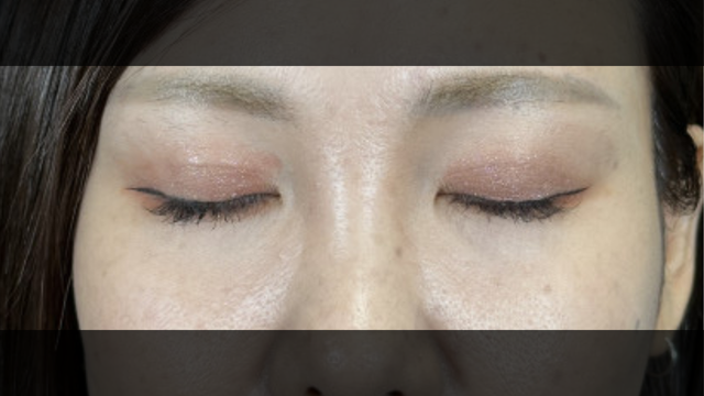 Postoperative Condition Part 1