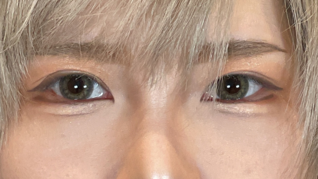 Postoperative Condition Part 1