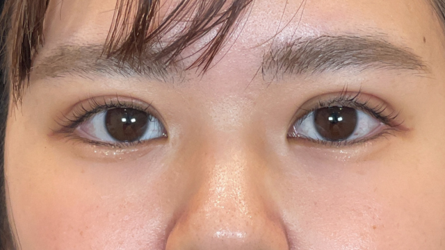 Postoperative Condition Part 1