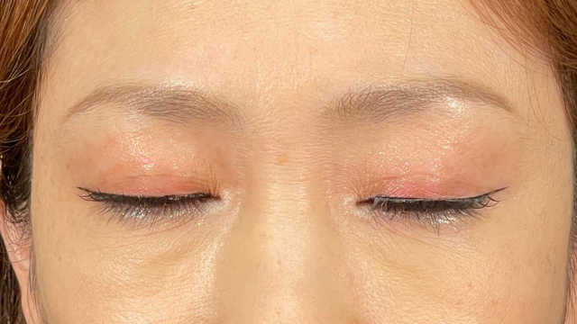 Postoperative Condition Part 1