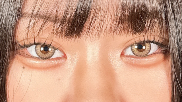 Postoperative Condition Part 1