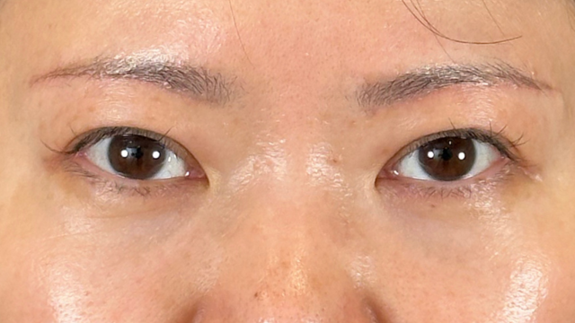 Postoperative Condition Part 1