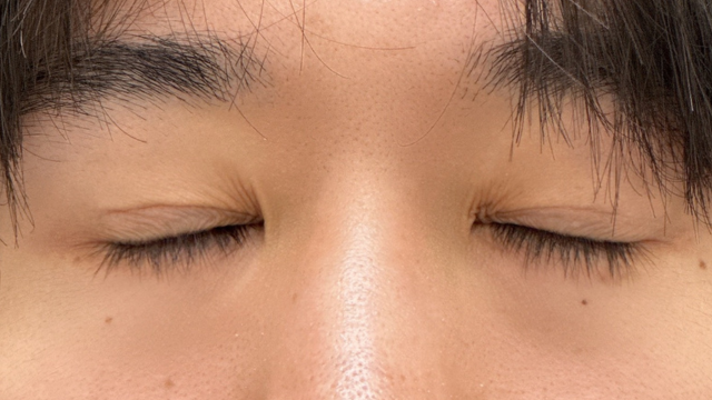 Postoperative Condition Part 1