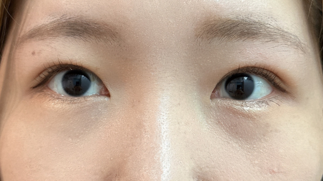 Postoperative Condition Part 1