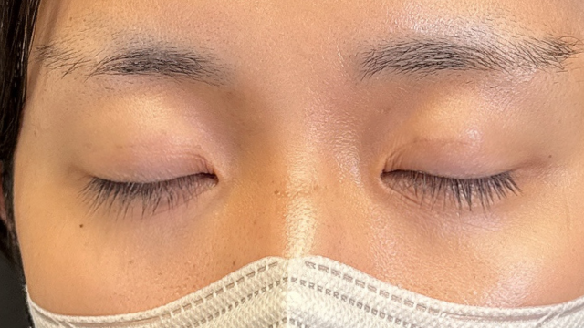 Postoperative Condition Part 1