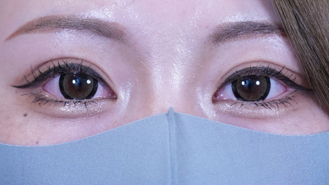 Postoperative Condition Part 1