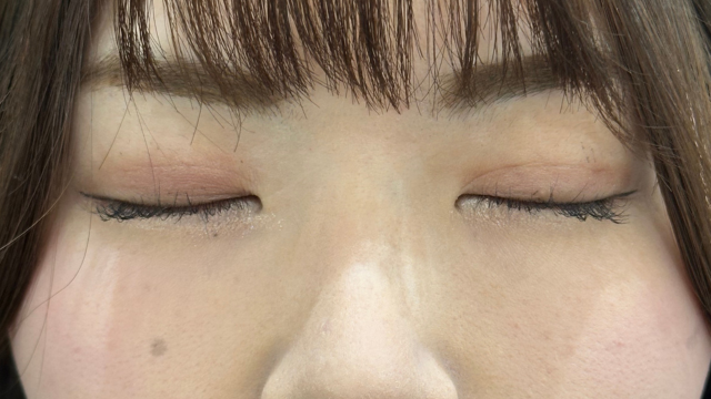 Postoperative Condition Part 1