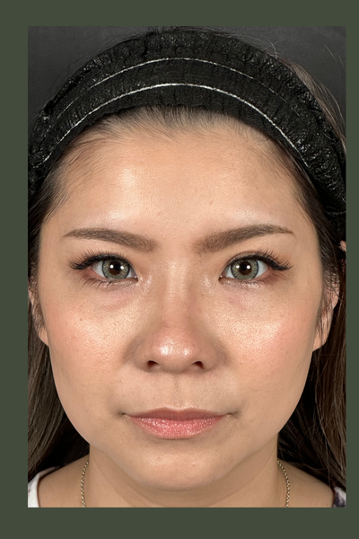 手術後の状態 その1