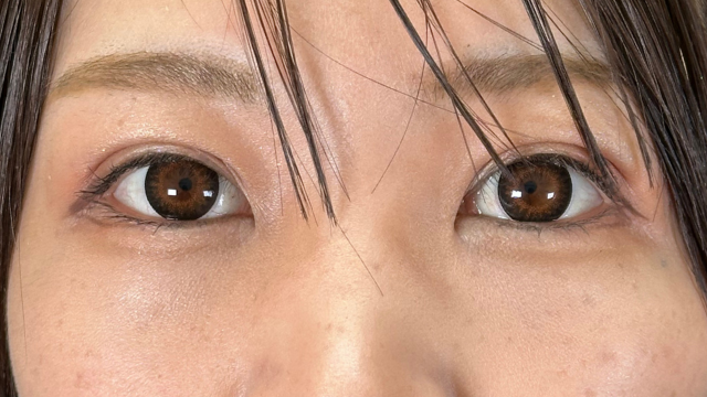 Postoperative Condition Part 1